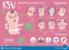 Virus hợp bào hô hấp: Tác nhân gây bệnh nguy hiểm ở trẻ sơ sinh
