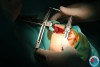 Bệnh viện Nhi Trung Ương hướng dẫn chuyển giao kỹ thuật phẫu thuật khe hở môi, vòm miệng ở trẻ em tại Bệnh viện Nhi Thái Bình (Đợt I năm 2022)