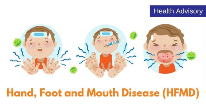 Bệnh Tay Chân Miệng: Những Điều Cha Mẹ Cần Biết Để Bảo Vệ Con