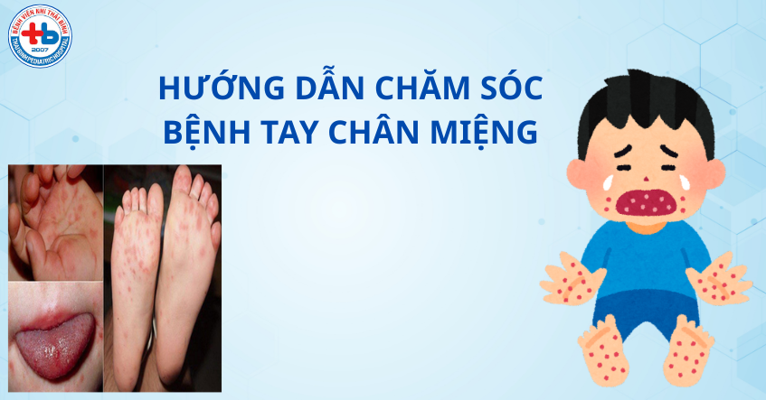 BỆNH TAY – CHÂN – MIỆNG Ở TRẺ EM: NHẬN BIẾT VÀ CHĂM SÓC